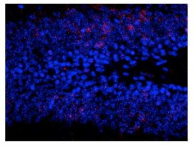 Immunohistochemistry: ERK1 [p Thr202, p Tyr204] Antibody [NB500-141]